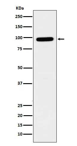 GLB1 Rabbit Monoclonal Antibody - Size: 50µl