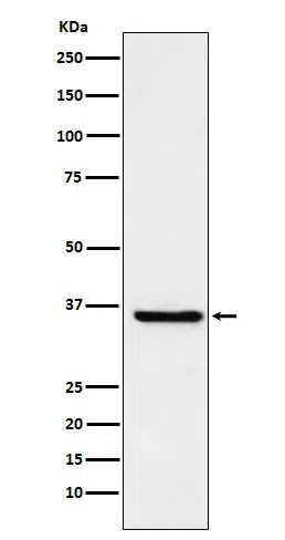 FGF19 Rabbit Monoclonal Antibody - Size: 100µl