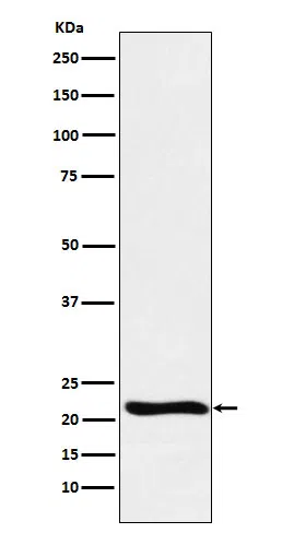 GLO1 Rabbit Monoclonal Antibody - Size: 100µl