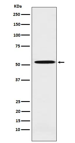 ALDH1A2 Rabbit Monoclonal Antibody - Size: 50µl