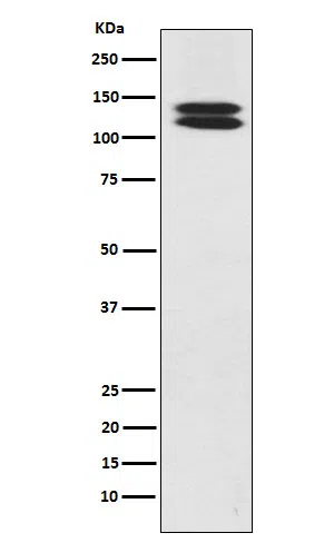 HCadherin Rabbit Monoclonal Antibody - Size: 100µl
