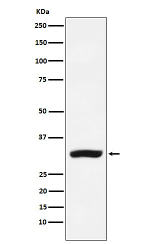 CBR1 Rabbit Monoclonal Antibody - Size: 100µl