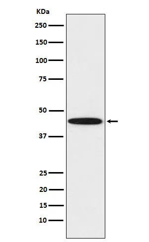 DDB2 Rabbit Monoclonal Antibody - Size: 100µl