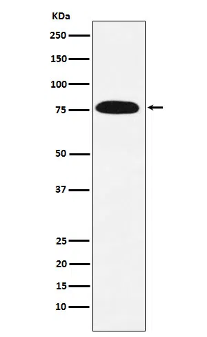 KHSRP Rabbit Monoclonal Antibody