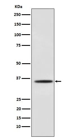 Myogenin Rabbit Monoclonal Antibody