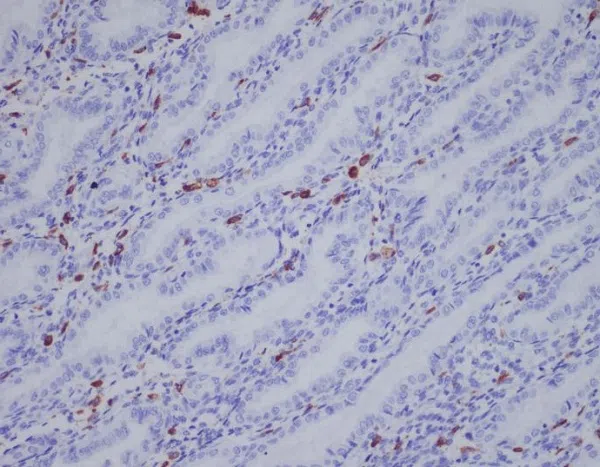 IBA1 Rabbit Monoclonal Antibody - Size: 50µl