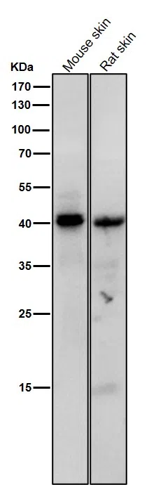 Phospho-PKAC(Thr197) Rabbit Monoclonal Antibody - Size: 50µl