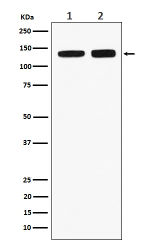 RNF40 Rabbit Monoclonal Antibody - Size: 50µl