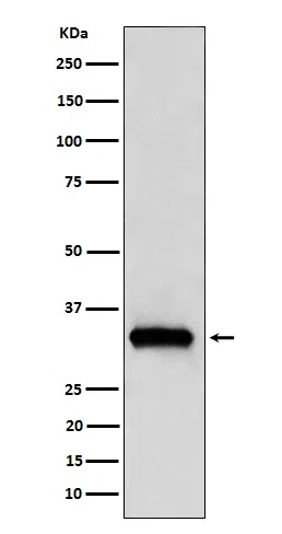 NDUFAF1 Rabbit Monoclonal Antibody - Size: 50µl