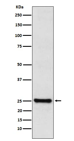 TPPP Rabbit Monoclonal Antibody - Size: 100µl