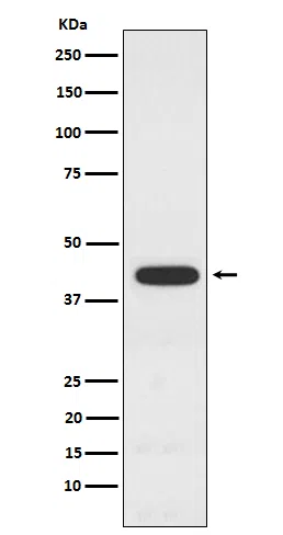 PCYT1A Rabbit Monoclonal Antibody - Size: 50µl