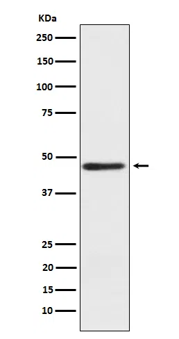 ENTPD5 Rabbit Monoclonal Antibody - Size: 100µl