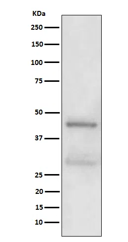 MBD2 Rabbit Monoclonal Antibody - Size: 50µl