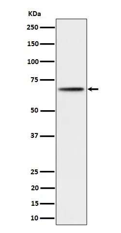 Phospho-P70S6 Kinase beta(S371) Rabbit Monoclonal Antibody - Size: 100µl
