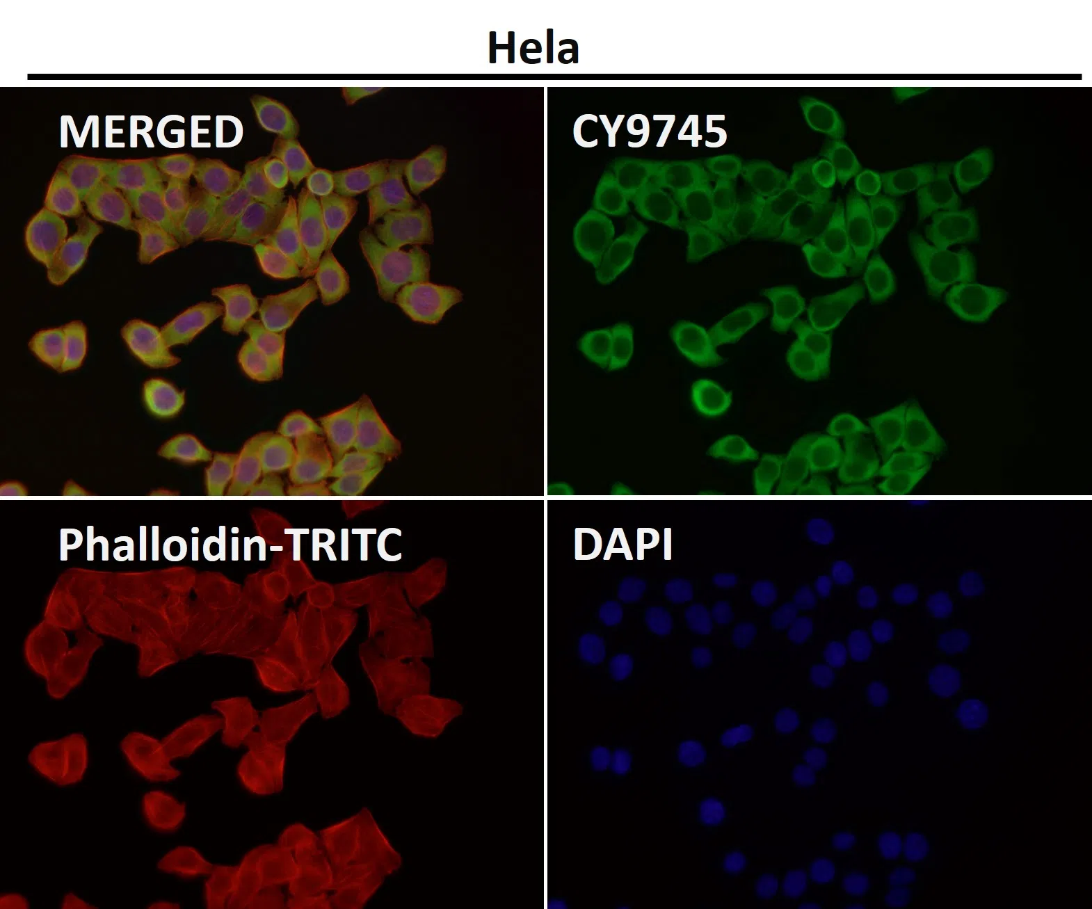 CD223 Rabbit Monoclonal Antibody - Size: 50µl
