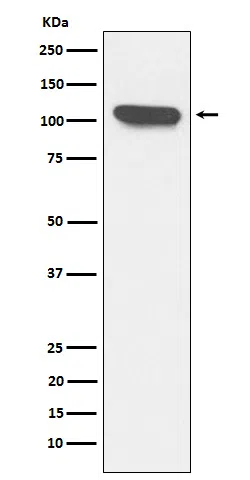 ERAP1 Rabbit Monoclonal Antibody - Size: 100µl