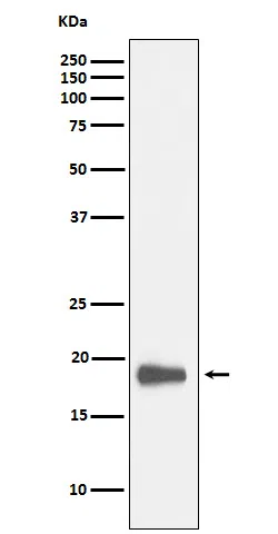 HMGN2 Rabbit Monoclonal Antibody - Size: 50µl