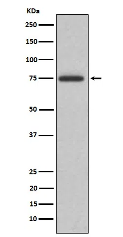 ABI2 Rabbit Monoclonal Antibody - Size: 50µl