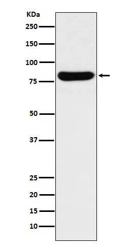 GUSB Rabbit Monoclonal Antibody - Size: 100µl