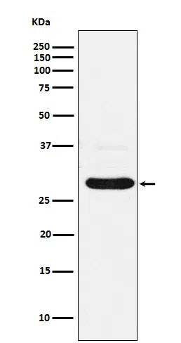 CHMP2B Rabbit Monoclonal Antibody - Size: 100µl