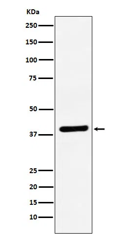 VEGFD Rabbit Monoclonal Antibody - Size: 50µl