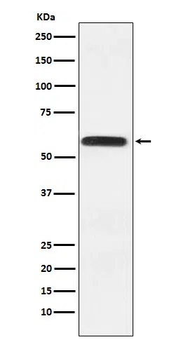 Lgi1 Rabbit Monoclonal Antibody - Size: 50µl