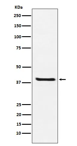 Arg2 Rabbit Monoclonal Antibody - Size: 50µl