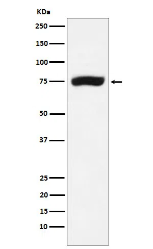 XPD Rabbit Monoclonal Antibody - Size: 100µl