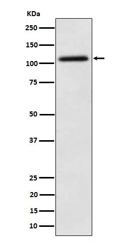 NAT10 Rabbit Monoclonal Antibody - Size: 50µl