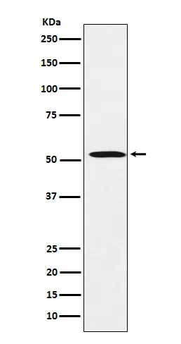 FADS1 Rabbit Monoclonal Antibody - Size: 50µl