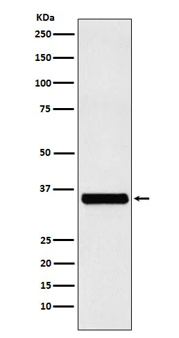 EXOSC7 Rabbit Monoclonal Antibody - Size: 50µl