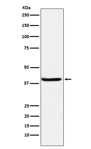 Serpin B3 Rabbit Monoclonal Antibody