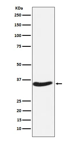 EXOSC7 Rabbit Monoclonal Antibody - Size: 100µl