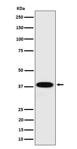 Cathepsin H Rabbit Monoclonal Antibody - Size: 50µl