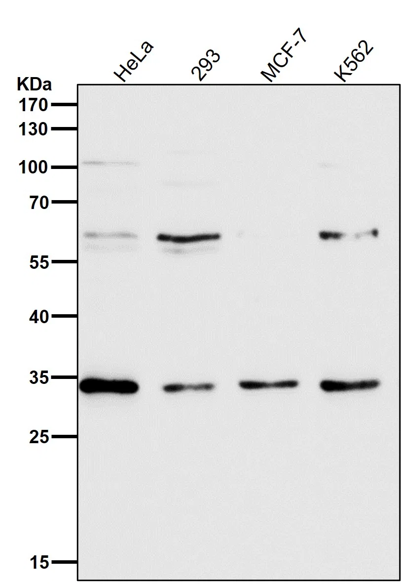 NUDT5 Rabbit Monoclonal Antibody - Size: 50µl