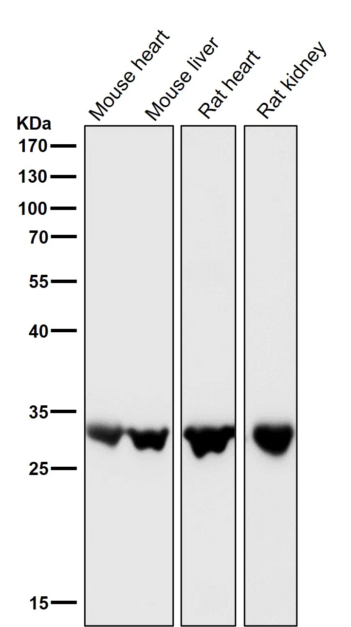 UPP1 Rabbit Monoclonal Antibody