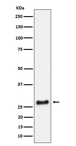 SNRPA1 Rabbit Monoclonal Antibody - Size: 100µl