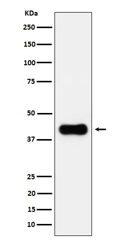 ACAA2 Rabbit Monoclonal Antibody - Size: 100µl