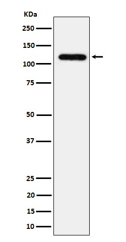 UBE4A Rabbit Monoclonal Antibody - Size: 100µl