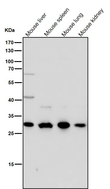 CTR1/SLC31A1 Rabbit Monoclonal Antibody - Size: 50µl