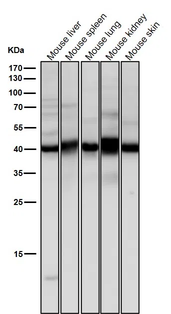 Erlin-2 Rabbit Monoclonal Antibody