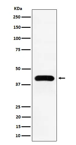 MVD Rabbit Monoclonal Antibody - Size: 100µl