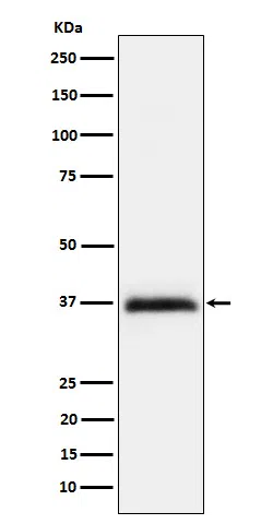 RGMA Rabbit Monoclonal Antibody - Size: 100µl