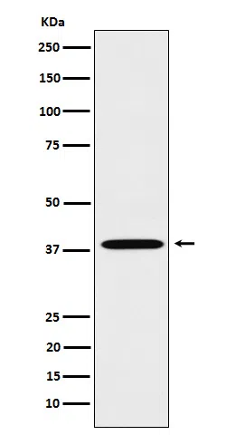 LTB4R Rabbit Monoclonal Antibody - Size: 100µl