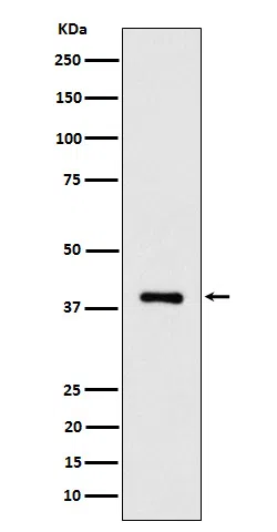 ACAT2 Rabbit Monoclonal Antibody - Size: 50µl