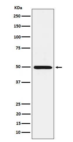 HGD Rabbit Monoclonal Antibody - Size: 50µl