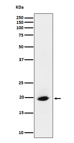 SRP19 Rabbit Monoclonal Antibody - Size: 50µl