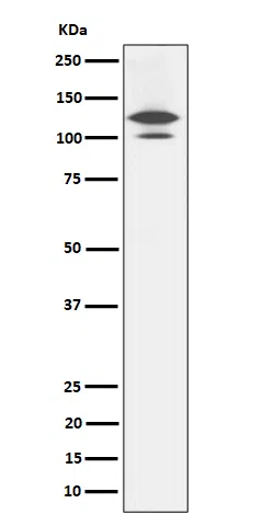 RASA1 Rabbit Monoclonal Antibody - Size: 50µl