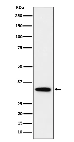 PPP6C Rabbit Monoclonal Antibody - Size: 50µl