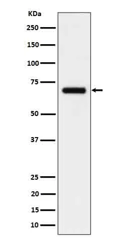 CD125 Rabbit Monoclonal Antibody - Size: 50µl